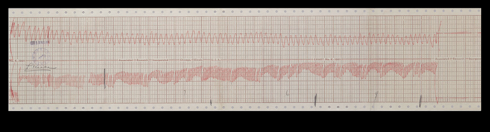 A reading from a Keeler Polygraph machine, 1940. Courtesy of the Leonard Keeler papers, UC Berkeley, Bancroft Library